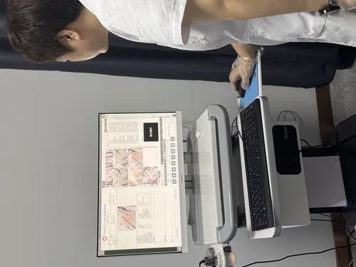 毛发镜检测